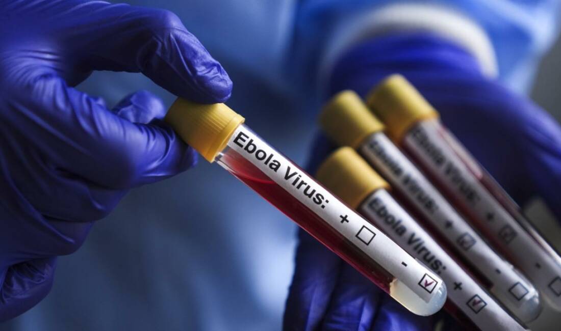 Kongo Demokratik Cumhuriyeti'nde (KDC) 15 Mayıs'ta ilan edilen Ebola salgınında