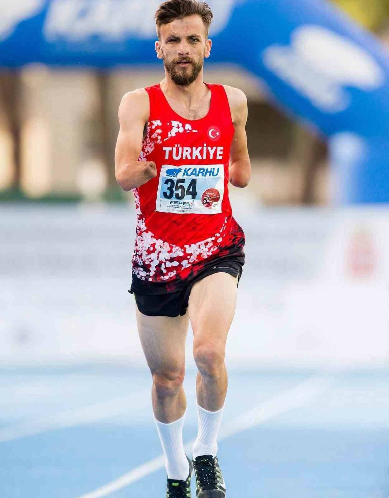 feci kazada ellerini kaybeden bayramin umut hikayesi 24b47213833d