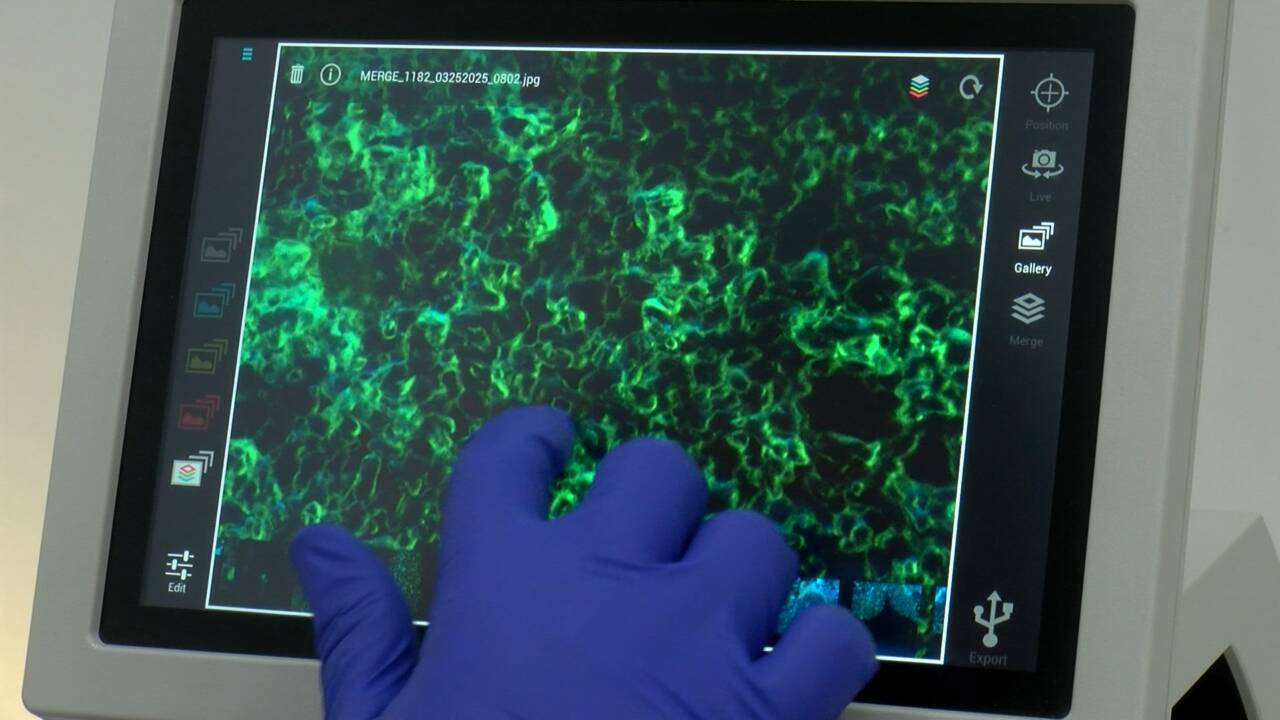 diyabet hastalarina bursa teknik universitesinden yeni umut c9cceea16ea3