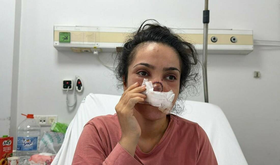 Kocası burnunu kopardı! Dehşet anlarını bu sözlerle anlattı Manisa'nın Turgutlu ilçesinde İmran Güler'in (28), eşi Gökhan Güler (29)