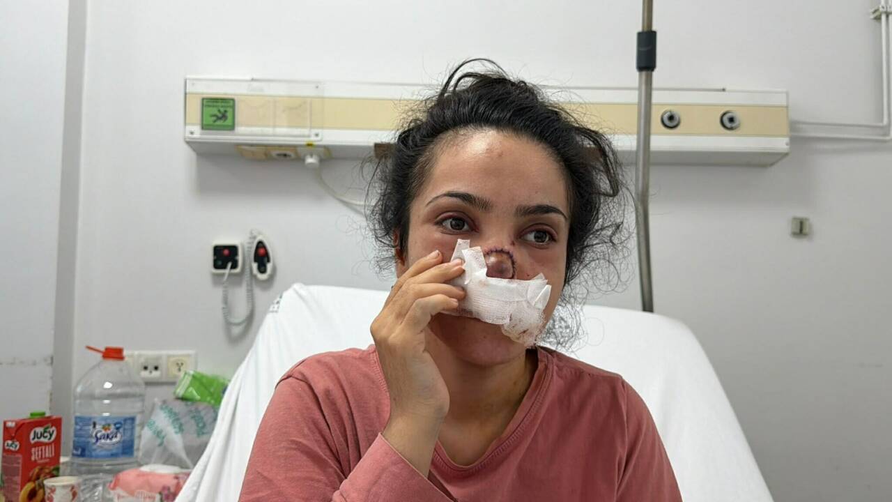 kocasi burnunu kopardi dehset anlarini bu sozlerle anlatti ae553eb82024